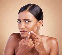 Acne & pigmentation