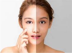 Skin Care